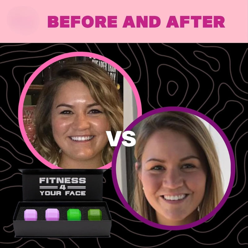 JawSculptr™ – The Ultimate Jawline Shaper