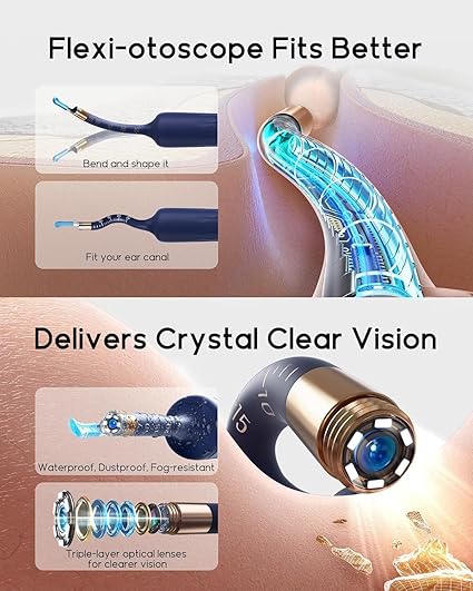 Ear Cleaner Tool Kit, Reusable Ear Wax Removal Tweezers Cleaning with Flexible 1080p Camera Wireless with WiFi