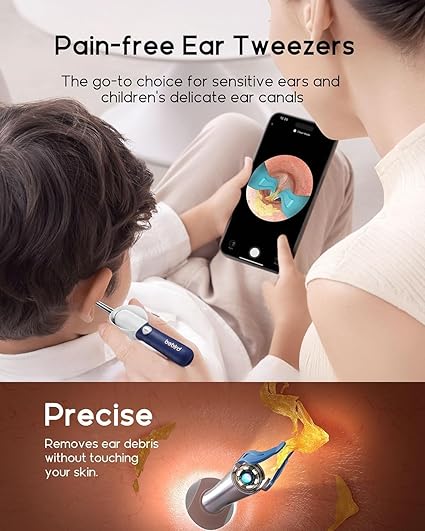 Ear Cleaner Tool Kit, Reusable Ear Wax Removal Tweezers Cleaning with Flexible 1080p Camera Wireless with WiFi